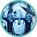 brain